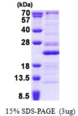 SDS-PAGE: Recombinant Human Ribosomal protein L26 His Protein [NBP2-23421]