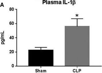 Detection of Rat IL-1 beta/IL-1F2
