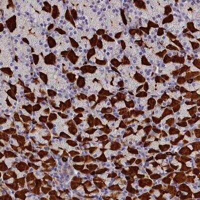 Immunohistochemistry: rotatin Antibody [NBP1-90554]