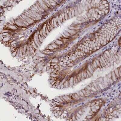 Immunohistochemistry-Paraffin: rotatin Antibody [NBP1-90555]