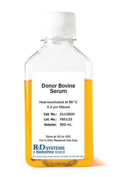 Donor Bovine Serum, Heat Inactivated