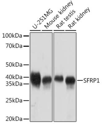 Western Blot: sFRP-1 Antibody (5I6V1) [NBP3-16851]