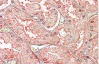 Immunohistochemistry-Paraffin: sFRP-1 Antibody [NBP1-51926]