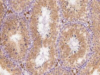 Immunohistochemistry-Paraffin: sFRP-1 Antibody [NBP2-99417]