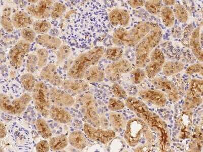 Immunohistochemistry-Paraffin: sFRP-1 Antibody [NBP2-99447]