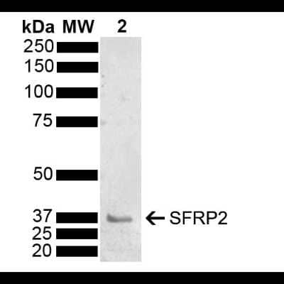 Western Blot: sFRP-2 Antibody [NBP3-18244]