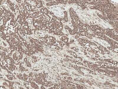 Immunohistochemistry: sFRP-2 Antibody [NBP3-18244]