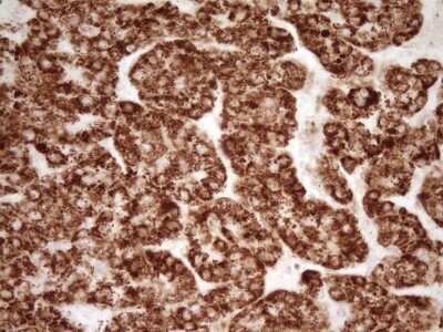Immunohistochemistry: sFRP-2 Antibody (OTI6C2) - Azide and BSA Free [NBP2-74151]