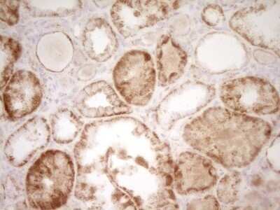 Immunohistochemistry: sFRP-2 Antibody (OTI6C2) - Azide and BSA Free [NBP2-74151]