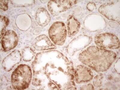 Immunohistochemistry: sFRP-2 Antibody (OTI6C2) [NBP2-45804]