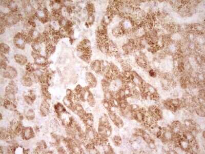 Immunohistochemistry: sFRP-2 Antibody (OTI6C2) [NBP2-45804]