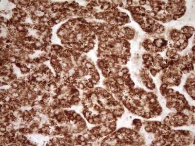Immunohistochemistry: sFRP-2 Antibody (OTI6C2) [NBP2-45804]