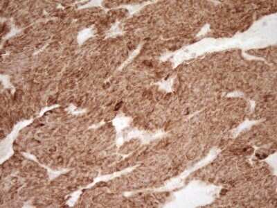 Immunohistochemistry: sFRP-2 Antibody (OTI6C2) [NBP2-45804]
