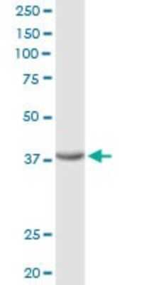 Western Blot: sFRP-3/FRZB Antibody [H00002487-D01P]