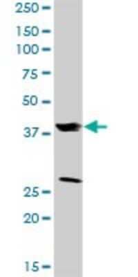 Western Blot: sFRP-3/FRZB Antibody [H00002487-D01P]