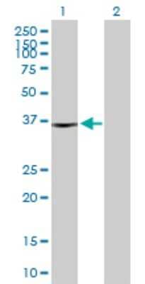 Western Blot: sFRP-3/FRZB Antibody [H00002487-D01P]