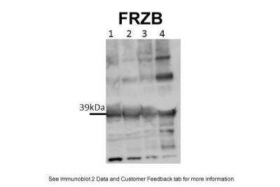 Western Blot: sFRP-3/FRZB Antibody [NBP1-79552]