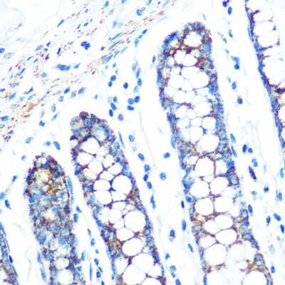 Immunohistochemistry-Paraffin: sFRP-4 Antibody (7Z6Q1) [NBP3-16352]