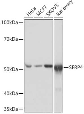 Western Blot: sFRP-4 Antibody (7Z6Q1) [NBP3-16352]