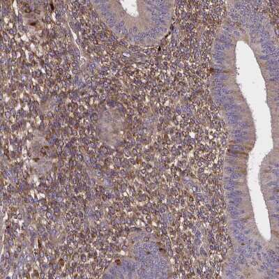 Immunohistochemistry-Paraffin: sFRP-4 Antibody [NBP1-81866]