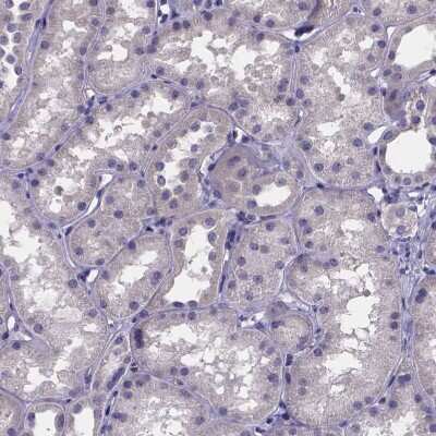 Immunohistochemistry-Paraffin: sFRP-4 Antibody [NBP1-81866]