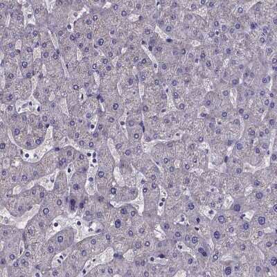 Immunohistochemistry-Paraffin: sFRP-4 Antibody [NBP1-81866]