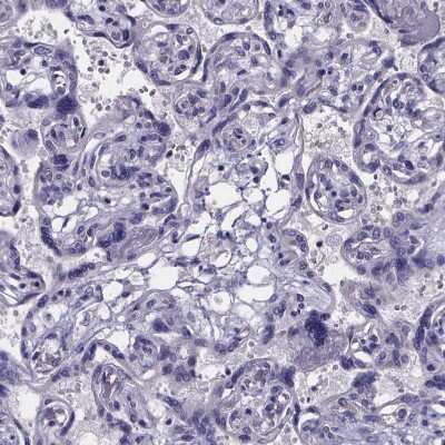 Immunohistochemistry-Paraffin: sFRP-4 Antibody [NBP1-81866]