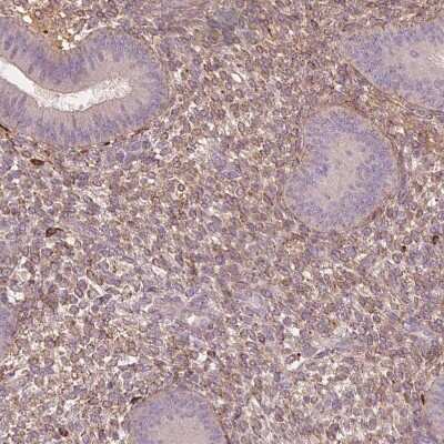 Immunohistochemistry-Paraffin: sFRP-4 Antibody [NBP2-38632]