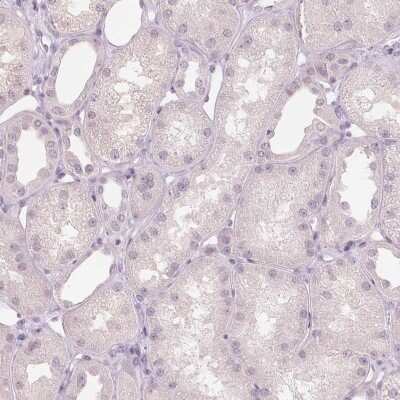 Immunohistochemistry-Paraffin: sFRP-4 Antibody [NBP2-38632]
