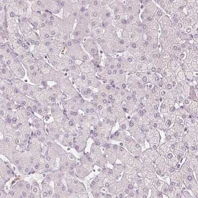 Immunohistochemistry-Paraffin: sFRP-4 Antibody [NBP2-38632]