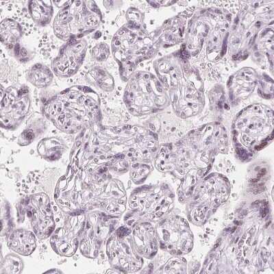 Immunohistochemistry-Paraffin: sFRP-4 Antibody [NBP2-38632]