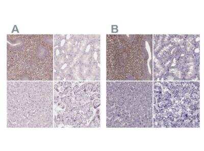 Immunohistochemistry-Paraffin: sFRP-4 Antibody [NBP2-38632]