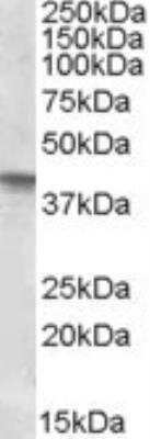 Western Blot: sFRP-4 Antibody [NBP1-36985]