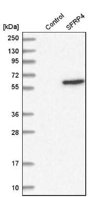 Western Blot: sFRP-4 Antibody [NBP1-81866]