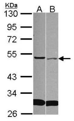 Western Blot: sFRP-4 Antibody [NBP2-20330]