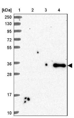 Western Blot: sFRP-4 Antibody [NBP2-38632]