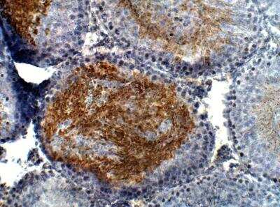 Immunohistochemistry-Paraffin: sFRP-5 Antibody [NBP3-12343]