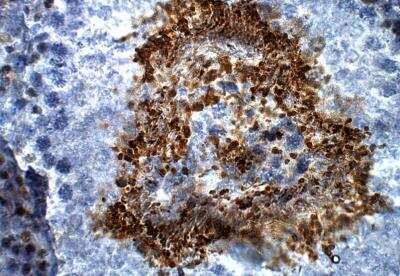 Immunohistochemistry-Paraffin: sFRP-5 Antibody [NBP3-12343]