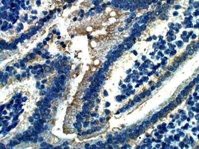 Immunohistochemistry-Paraffin: sFRP-5 Antibody [NBP3-12343]