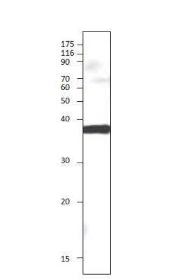 Western Blot: sFRP-5 Antibody [NBP3-12343]