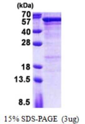 SDS-PAGE: Recombinant Human Semenogelin I His Protein [NBP2-23457]