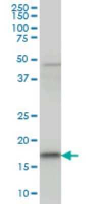 Western Blot: sen15 Antibody (8C7) [H00116461-M01]