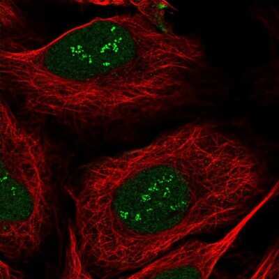 Immunocytochemistry/ Immunofluorescence: sen15 Antibody [NBP1-89888]