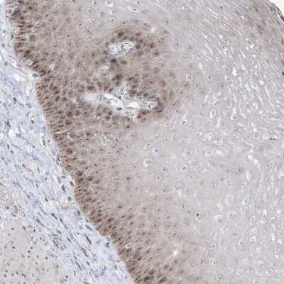 Immunohistochemistry-Paraffin: sen15 Antibody [NBP1-89888]