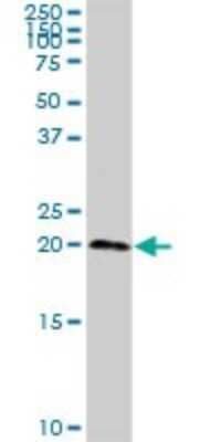 Western Blot: sen15 Antibody [H00116461-D01P]