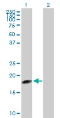 Western Blot: sen15 Antibody [H00116461-D01P]