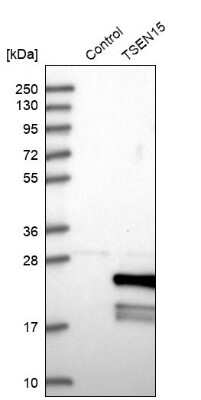 Western Blot: sen15 Antibody [NBP1-89888]