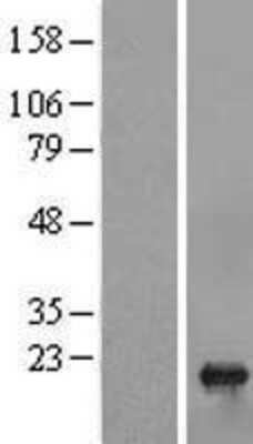 Western Blot: sen15 Overexpression Lysate [NBL1-17354]