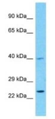 Western Blot: serine protease 55 Antibody [NBP3-09884]