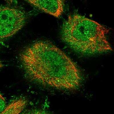 Immunocytochemistry/ Immunofluorescence: shootin-1 Antibody [NBP1-80753]